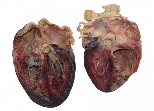 2020-07/dead-heart